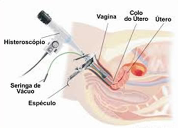 Servio